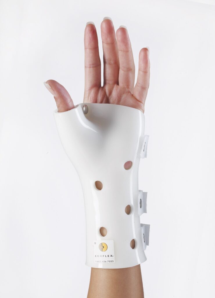 Orthotic device fabricated from Lamipro thermoplastic sheet